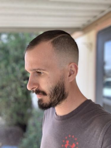 20 Trendy Haircuts for Balding Men 2025: Embrace Style with Top Cuts for Thinning Hair