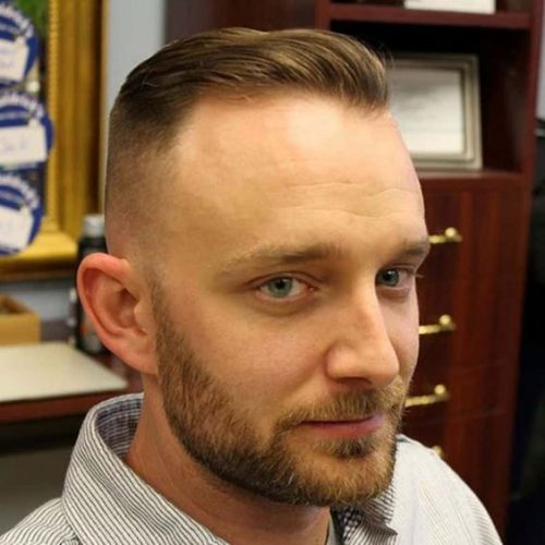 20 Trendy Haircuts for Balding Men 2025: Embrace Style with Top Cuts for Thinning Hair
