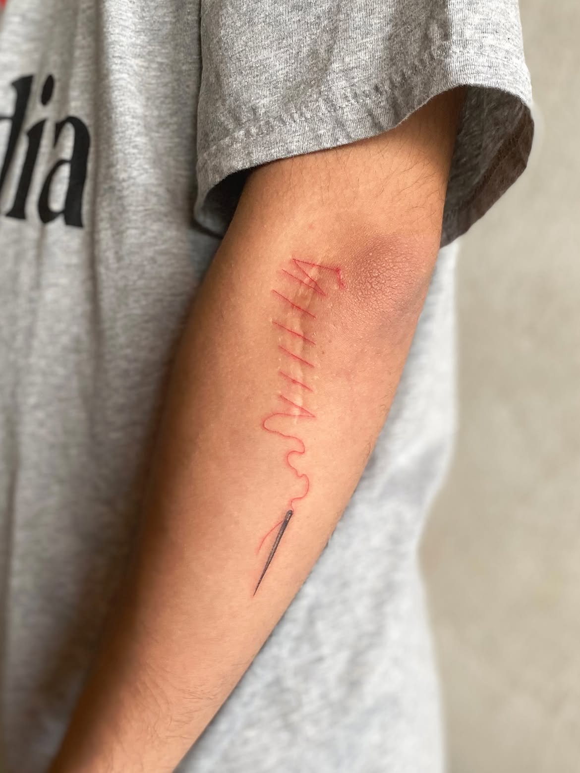 28 Scar Tattoo Ideas 2026: Creative Ways to Turn Scars Into Part of the Design