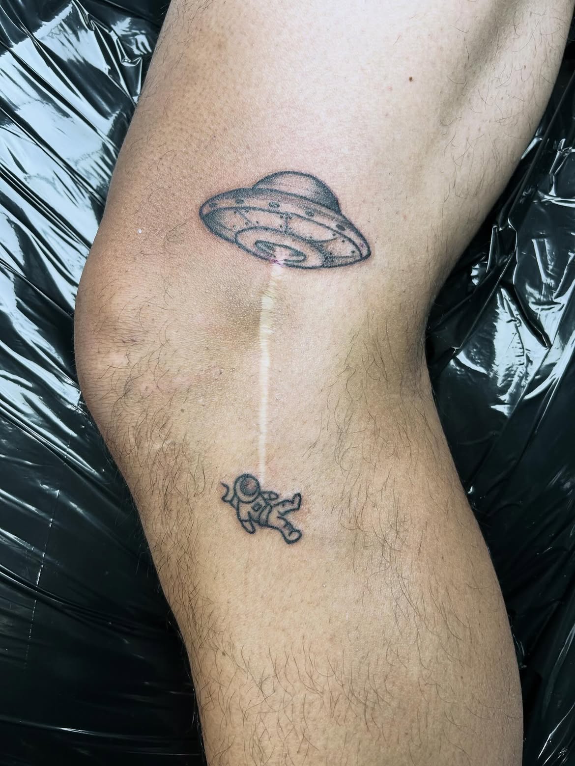 28 Scar Tattoo Ideas 2026: Creative Ways to Turn Scars Into Part of the Design