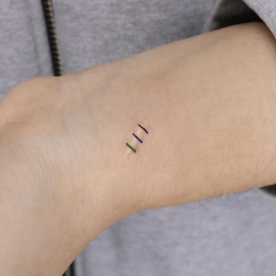28 Scar Tattoo Ideas 2026: Creative Ways to Turn Scars Into Part of the Design