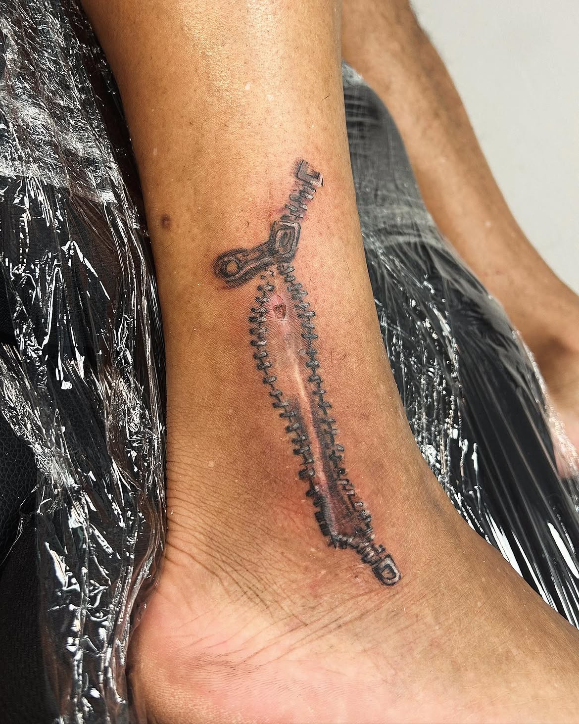 28 Scar Tattoo Ideas 2026: Creative Ways to Turn Scars Into Part of the Design