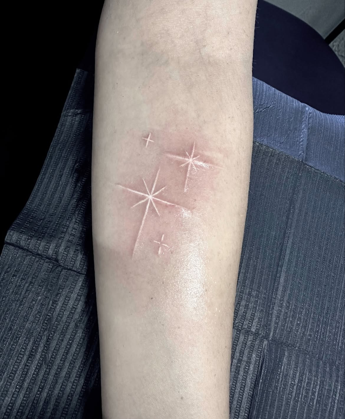 28 Scar Tattoo Ideas 2026: Creative Ways to Turn Scars Into Part of the Design