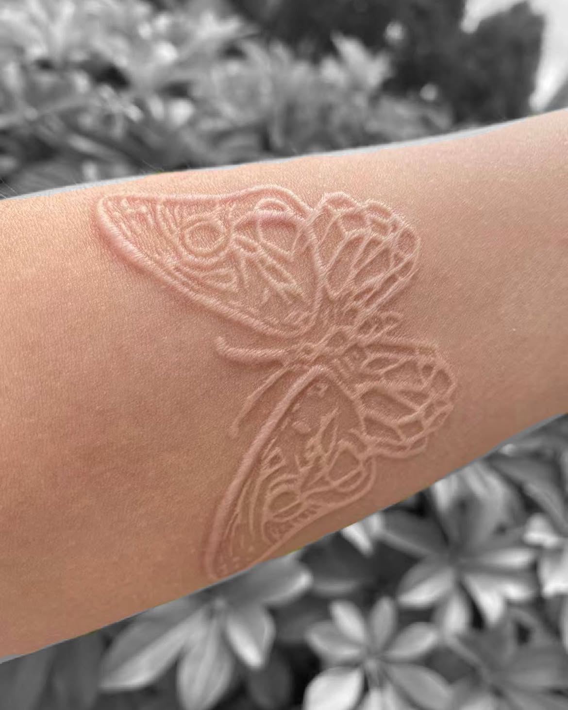 28 Scar Tattoo Ideas 2026: Creative Ways to Turn Scars Into Part of the Design