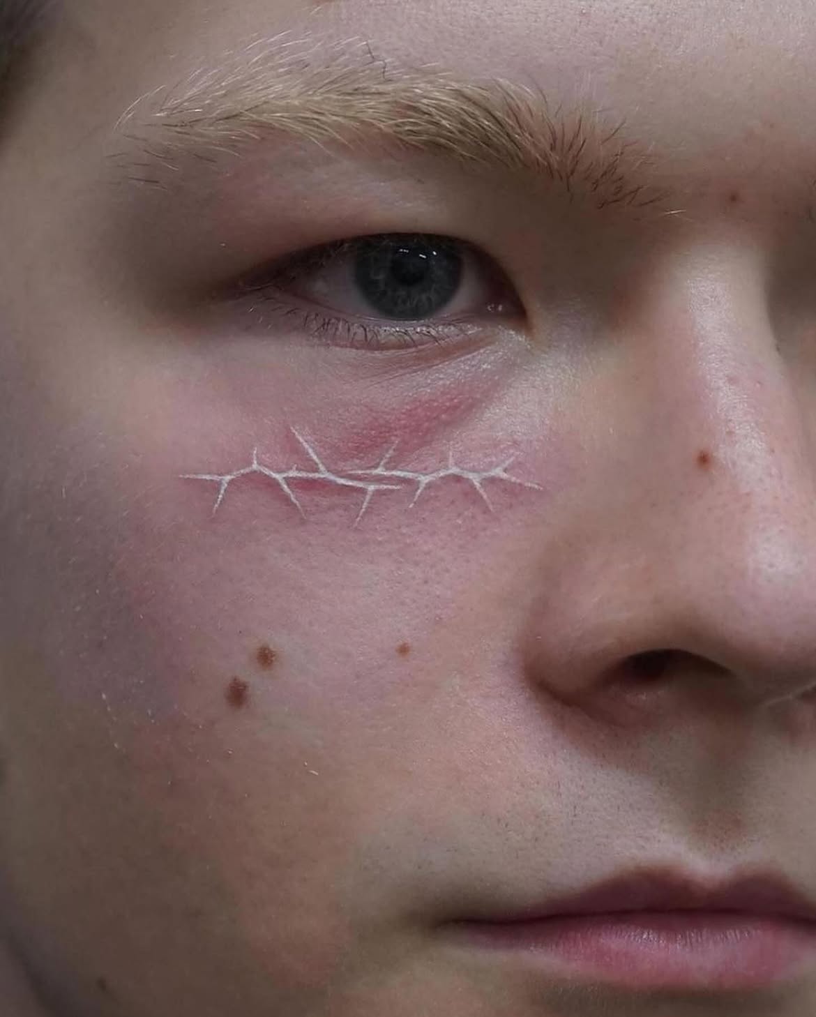 28 Scar Tattoo Ideas 2026: Creative Ways to Turn Scars Into Part of the Design